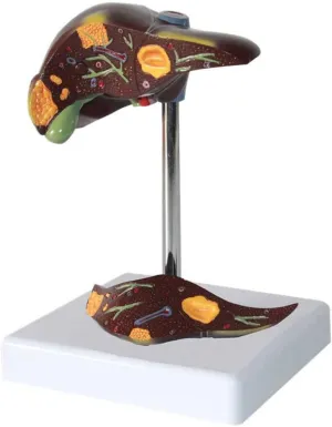 and 2 Detachable Parts for Learning and Understanding The S Teaching Model,Liver conscientious Pathology Teaching Model 1:1 Human Liver Anatomy Model with Clear Texture and Pathological Features 