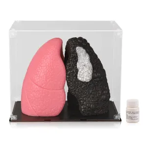 Model for Smoking Education - Life Size Healthy Lung vs. Smokers Lung Model Set, Lung frigid Anatomy 